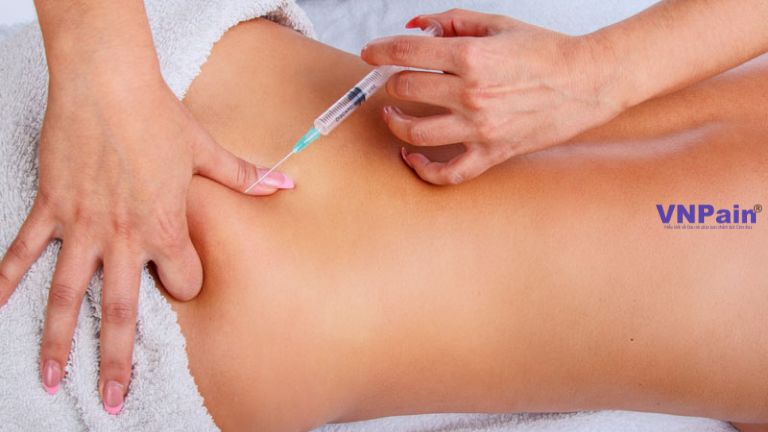 rối loạn chức năng khớp cùng chậu
