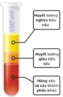 Huyết tương giàu tiểu cầu 