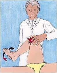 Chẩn đoán rách sụn chêm