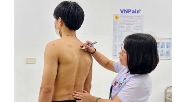 Đau lưng ngực