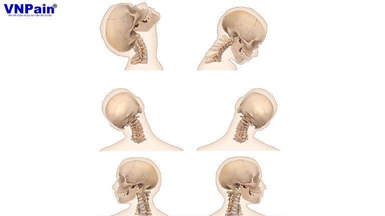Tầm vận động của cổ bị hạn chế ra sao sau phẫu thuật cố định cột sống?