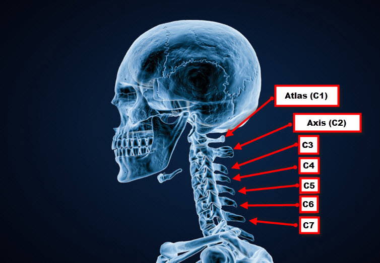 Tầm vận động cột sống cổ sau phẫu thuật cố định đa tầng